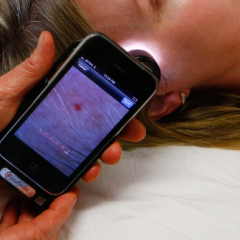 Mobile teledermoscopy